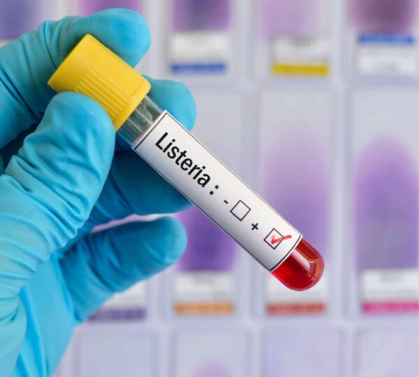 Read more about the article 10 Hospitalised as FDA Confirms Listeria Outbreak