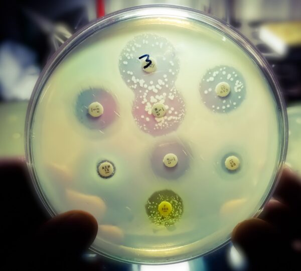 Research Explores Antimicrobial Coatings for Stone Fruits to Enhance Safety and Shelf Life