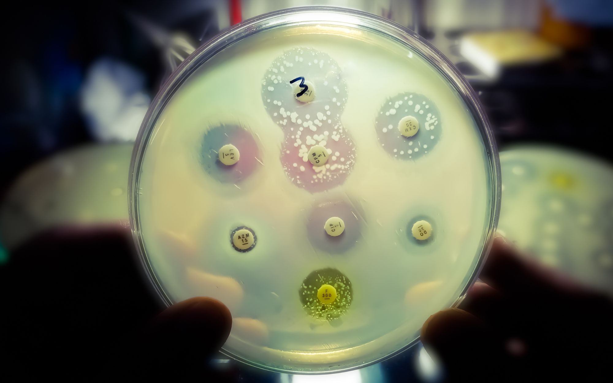 You are currently viewing Research Explores Antimicrobial Coatings for Stone Fruits to Enhance Safety and Shelf Life