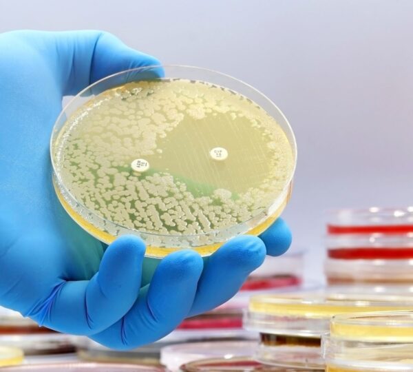 Read more about the article EFSA and ECDC Report Elevated Antimicrobial Resistance in Salmonella and Campylobacter, Urgent Action Required