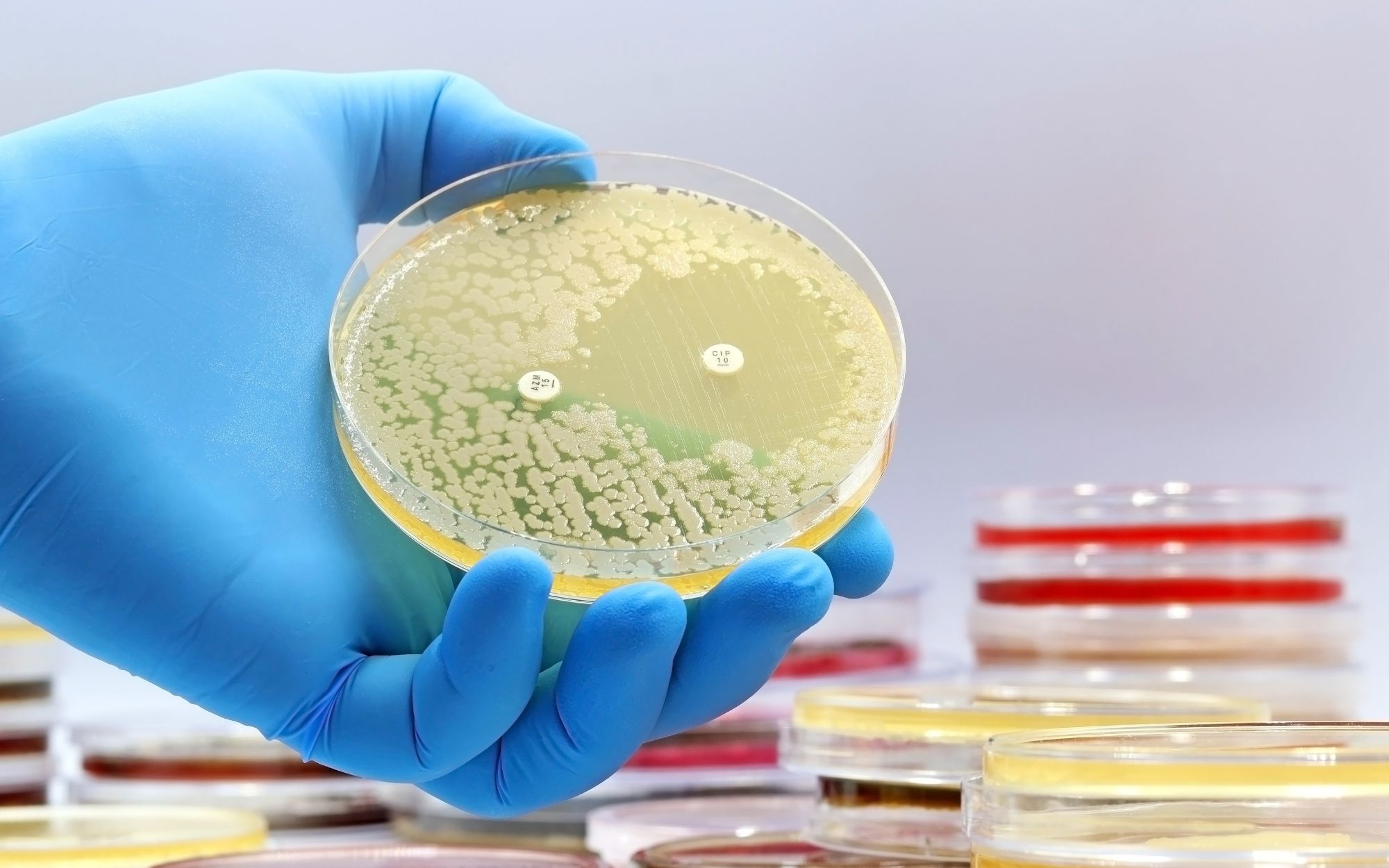 You are currently viewing EFSA and ECDC Report Elevated Antimicrobial Resistance in Salmonella and Campylobacter, Urgent Action Required