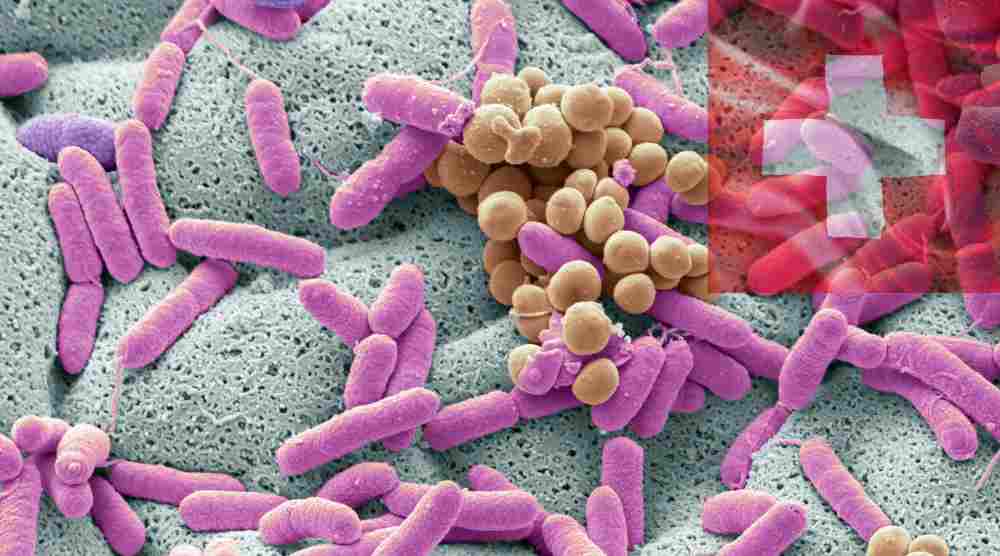 “Scientists hope new Swiss system will help in Listeria battle